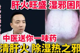 肝火旺盛、湿邪困阻，中医送你1味药，清肝火、除湿热之邪！视频封面