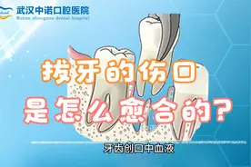 牙齿拔出后的拔牙窝是如何愈合的呢？视频封面