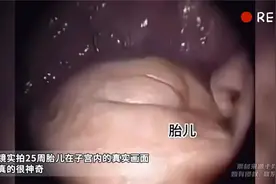 胎儿镜实拍25周胎儿在子宫内的真实画面，生命真的很神奇视频封面