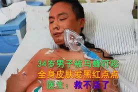34岁男子被上千只马蜂叮咬，全身都是红点点，医生：没得救了视频封面