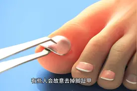 为什么一些马拉松运动员跑步前会去除脚指甲视频封面