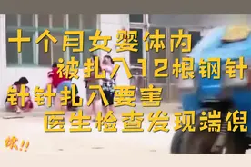 十个月女婴体内被扎入12根钢针，针针扎入要害，医生检查发现端倪