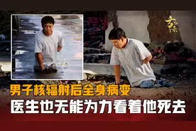 男子被核辐射后全身病变，医生切掉他半个身体，眼睁睁看着他死去