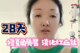 角质层薄就会出现红血丝！我教你28天修复受损角质层，淡化红血丝视频封面