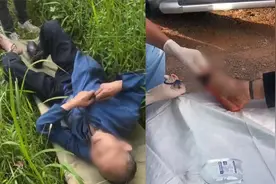 8旬老人上山采药被五步蛇咬伤，皮肤2小时变黑溃烂，救治现场！