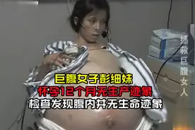 巨腹女子彭细妹，怀孕12个月还没临盆，检查发现腹内并无生命迹象视频封面