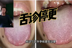 感谢恩师倪海厦指引，传承中医文化舌诊视频教程，宫外孕的部位视频封面
