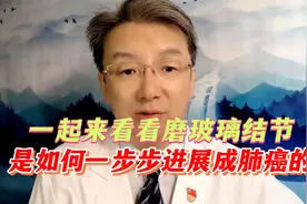 磨玻璃结节如何一步步演变为肺癌?需要多少年？结合图片细说真相视频封面