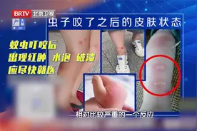 蚊虫叮咬不是小事，出现这些症状应立即就医！花露水也别滥用！视频封面