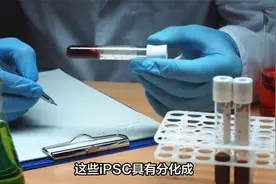 震撼！自体再生胰岛移植成功，全球首例2型糖尿病获完全治愈视频封面