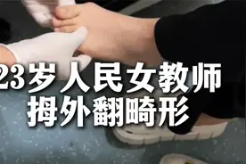 23岁人民女教师拇外翻畸形视频封面