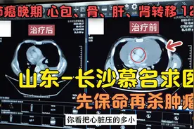 肺癌晚期全身转移，北京医院判死刑，慕名到长沙，标本兼治获新生视频封面