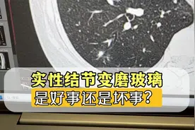 肺实性结节，随访变成磨玻璃结节，是好事还是坏事？视频封面