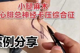 小腿麻木，当心腓总神经卡压综合征。案例分享视频封面