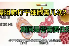 慢阻肺打干细胞需几次？期间是否需要住院视频封面