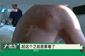 男子突发带状疱疹，额头长满水泡，医生：免疫力低下可诱发！