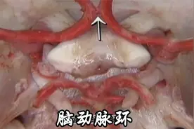 大脑的双保险：脑动脉环视频封面