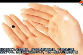 观相识人“中指上的痣”！视频封面