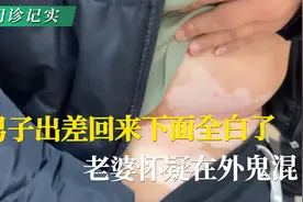 男子出差回来下面全白了，老婆怀疑在外鬼混！#白癜风 #白斑视频封面