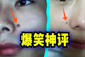 爆笑解说：痣长在鼻子旁边有什么意义吗？视频封面