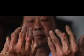 痛风还能吃鱼吗？视频封面