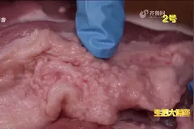 梅花肉是血脖肉吗？医生告诉你真相，一起来看丨生活大调查视频封面