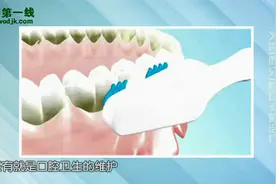 义齿(假牙)性口炎的治疗视频封面