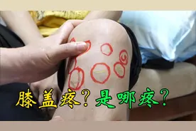 膝关节不同地方的疼痛，说明不同疾病，骨科医生帮您辨别视频封面