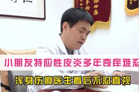 小朋友患特应性皮炎，晚上痒得睡不着，浑身抓痕医生看后不忍直视视频封面