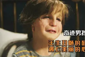 电影：整容27次的天使，看哭无数人的男孩，或许会改变你的人生观视频封面
