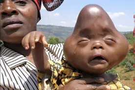 这个新生儿非常奇特，一出生就把全村人吓到了视频封面