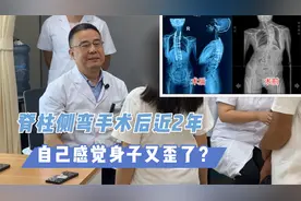 脊柱侧弯手术后2年，感觉自己身子又歪了正常吗？