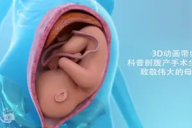 3D动画带你科普剖腹产手术全过程，致敬伟大的母亲！视频封面
