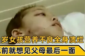 十岁女孩全身溃烂，曾被父母抛弃十年，死前只想见父母最后一面视频封面