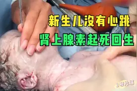 真实记录新生儿抢救全过程，5针肾上腺素下去，奇迹出现！视频封面
