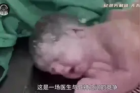 新生儿呛羊水抢救的全过程，看完很震惊。视频封面
