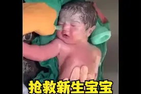 75. 医生全力抢救，新生宝宝，大家看到最后情况怎么样？视频封面