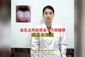 碰见这种齿痕舌千万别健脾，病根在阳虚！视频封面