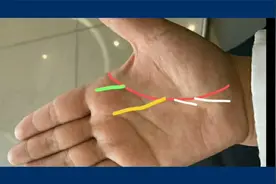 生命线出现“向上或向下分叉”的手相