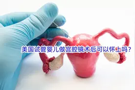 美国试管婴儿做宫腔镜术后可以怀上吗？视频封面