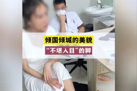 拇外翻妨碍了姑娘倾国倾城视频封面