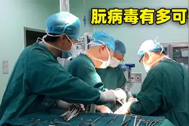 神秘的朊病毒，能让人狂笑而死，也能让动物患上这种著名的传染病