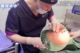 全程实拍：46岁来做微创去眼袋，术中直呼不痛，15天后状态太赞了视频封面