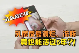 乳腺癌，乳房反复溃烂、流脓，乳头全烂掉！竟活过五年，临床治愈视频封面