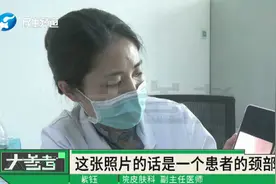 脖子上长这种“小肉粒”，千万别乱扣抓，当心是hpv感染的丝状疣视频封面