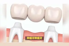 重阳节丨老年人牙齿缺失，镶哪种假牙比较好？