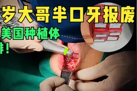 56岁大哥半口牙报废，6颗美国种植体，安排！视频封面