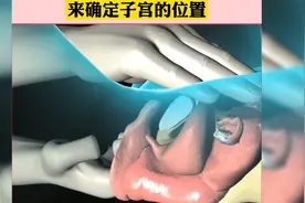 #子宫内膜 活检的第一视角！ #医学科普