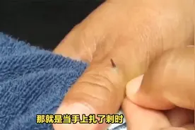 手上扎了刺别再用针挑了，教你一招刺自己跑出来，学会涨知识了！视频封面