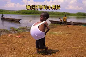 五岁男孩肚子大如水缸，家人无力治疗，网友伸出援手视频封面